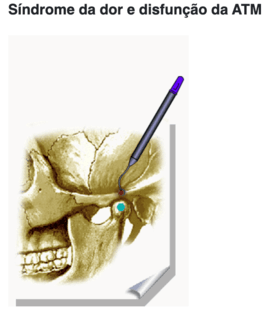 Dor orofacial / ATM