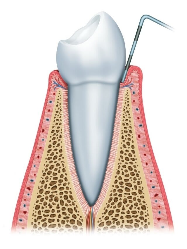 Sulco Gengival